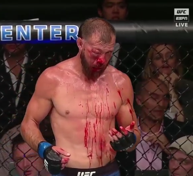 Tony Ferguson phán muốn tái đấu với Donald Cerrone vì thắng kiểu này không vui Tony Ferguson phán muốn tái đấu với Donald Cerrone vì thắng kiểu này không vui